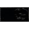 Керамическая плитка Equipe Cottage 21946 Black Gloss 7.5x15
