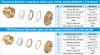 Кольцо фиксирующее Lavita CRIMPING RING 25А фото 2