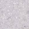 Керамогранит Laparet Matrix K952738R0001LPET Светло-Серый 60x60 фото 8