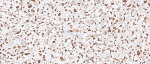 Керамогранит Italgraniti Charm Experience CH09XPL Pink Lap.SQ. 6mm 120X280